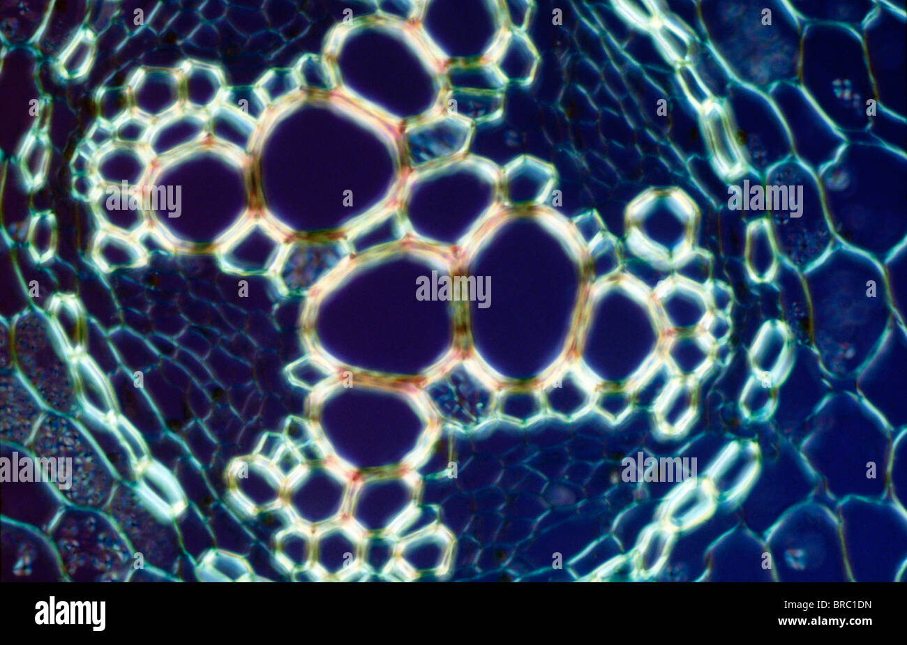 Micrografia di luce (LM) di una sezione trasversale che mostra lo xilema della radice di Ranunculus repens (Ranuncolo strisciante) Foto Stock