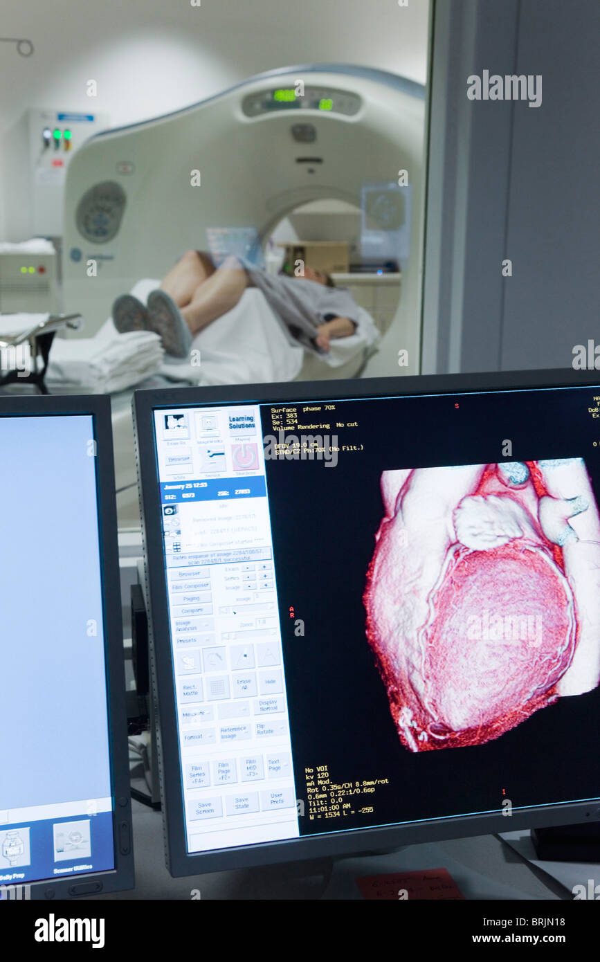 Il cuore del paziente CAT risultato di scansione mostrato sul monitor Foto Stock