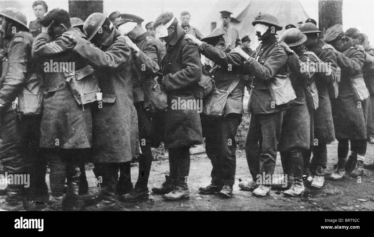 Prima guerra mondiale British 55th (West Lancashire) Divisione truppe accecati dal gas lacrimogeni nella battaglia di Estaires, Belgio, 10 aprile 1918 Foto Stock