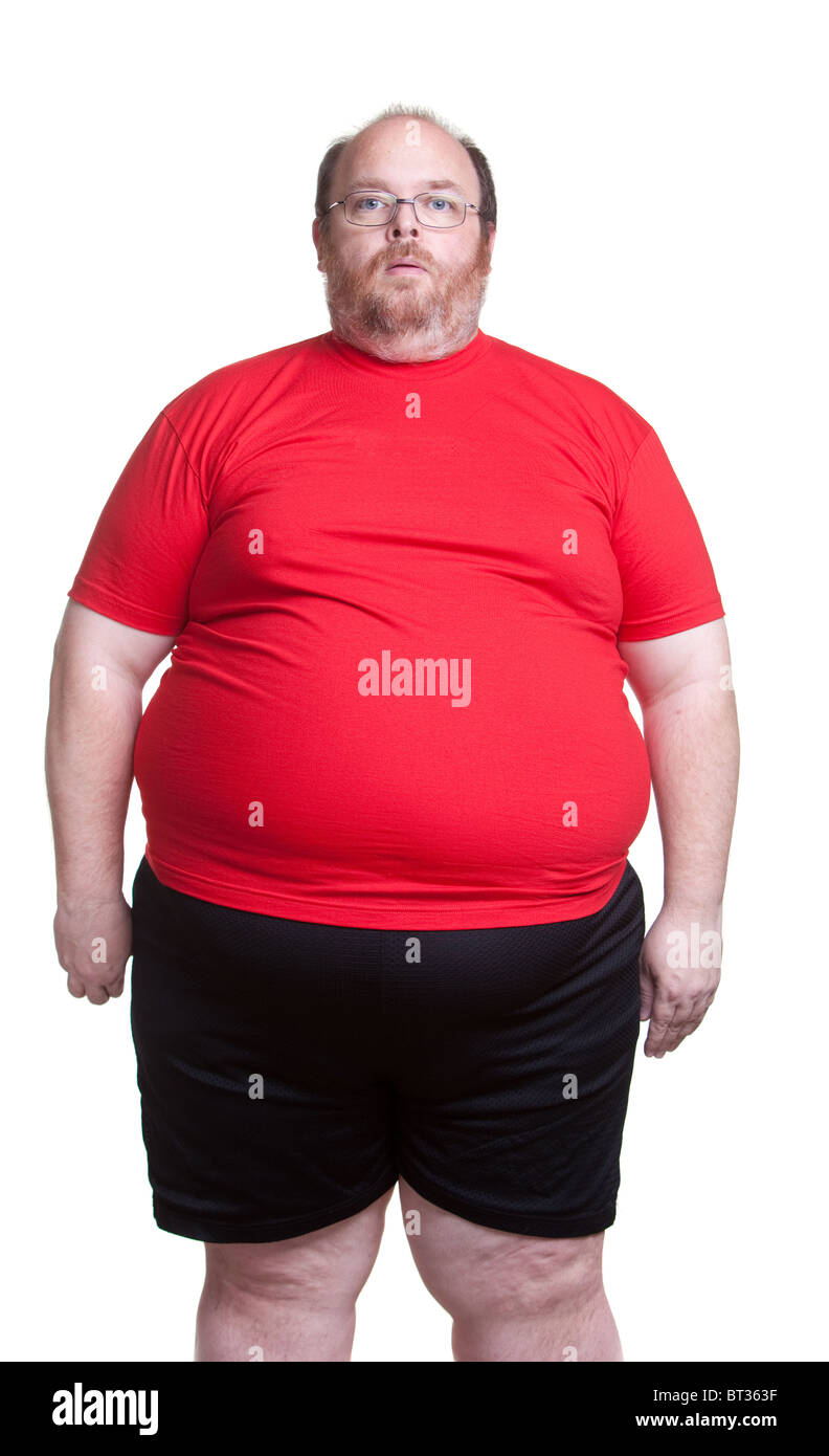 Uomo obesi a 400lbs - anteriore Foto Stock