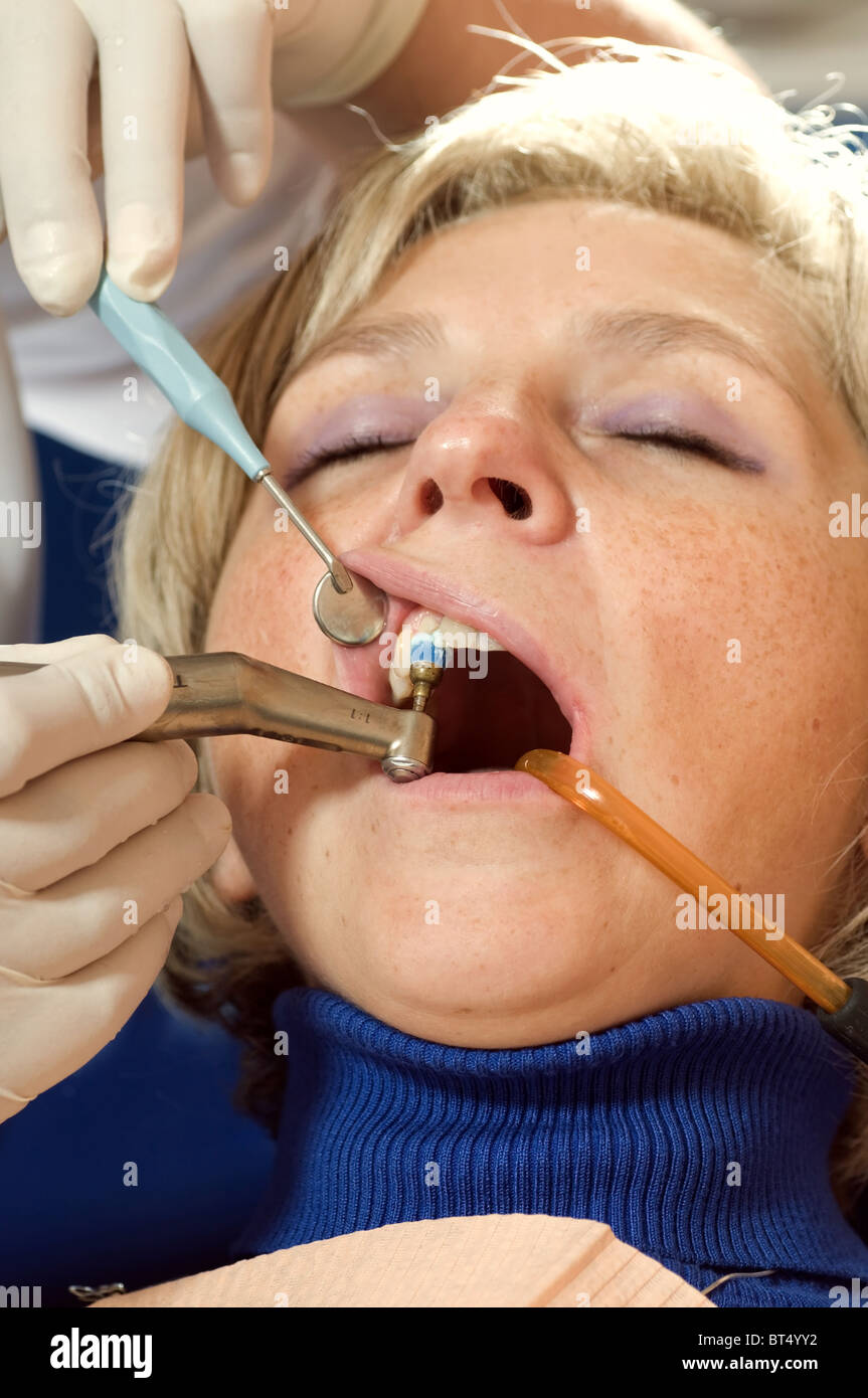 Presso il dentista - sbiancamento dei denti Foto Stock