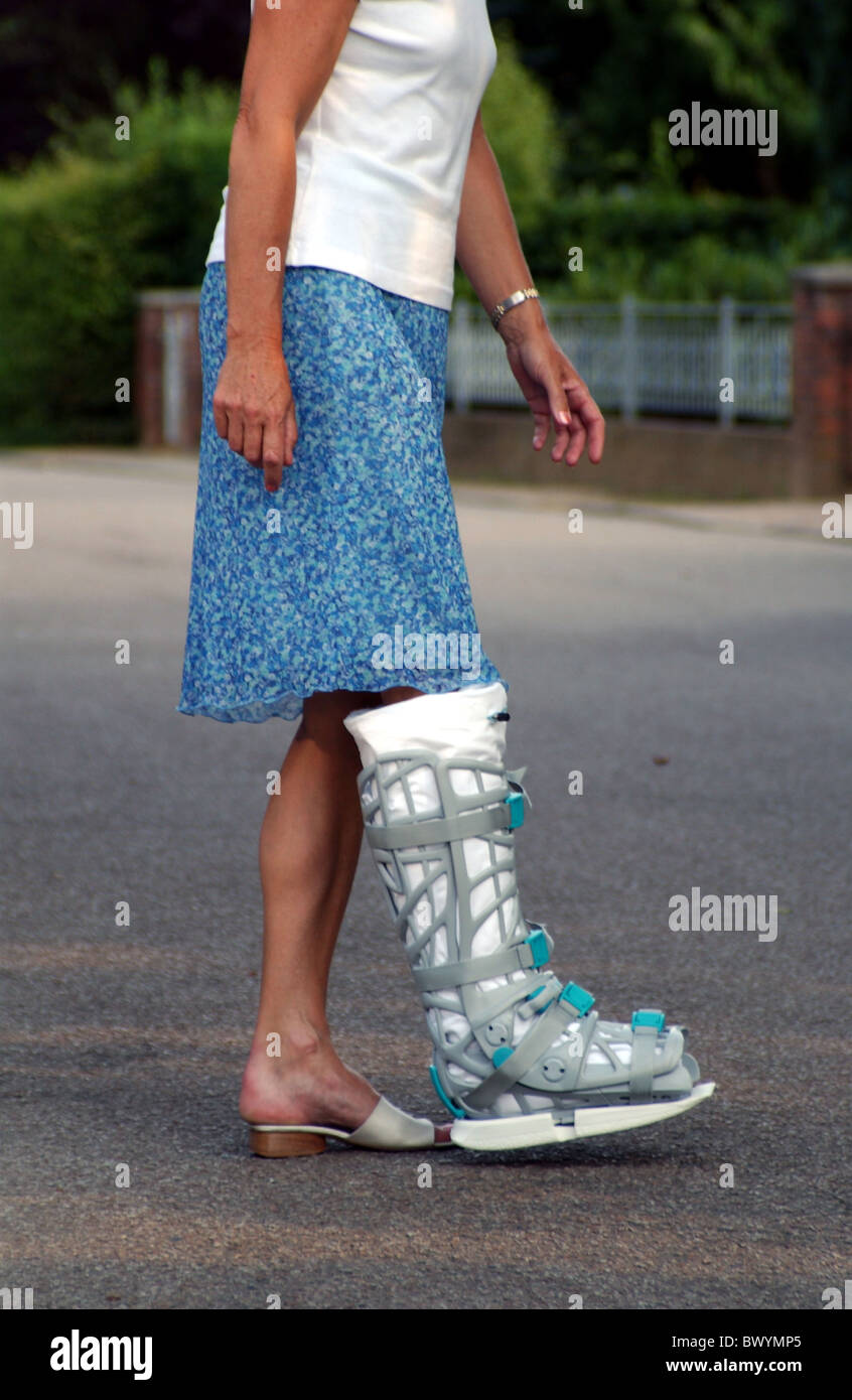 Dettaglio gesso salute medicina della gamba al di fuori di plastica di  recupero di terapia di riabilitazione a piedi scarpe aiutare Woma Foto  stock - Alamy