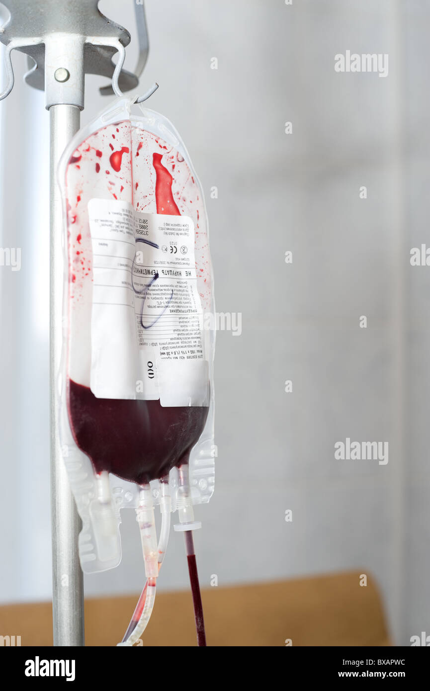 Confezione trasparente appeso sul rack è riempita con il sangue del donatore Foto Stock