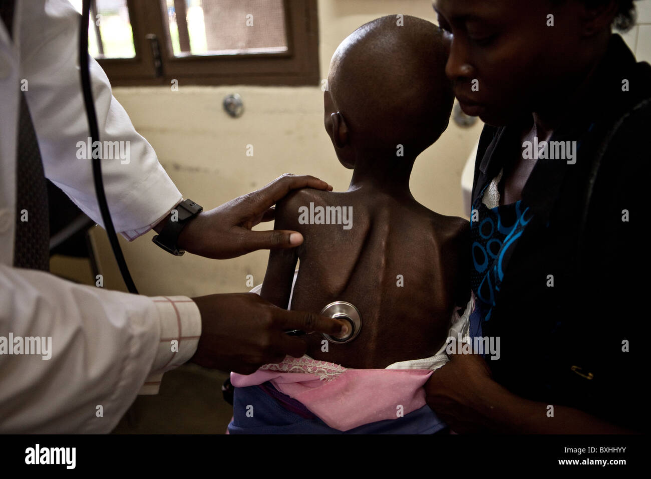 Un bambino muore di AIDS è esaminato da un medico come lei è controllato in un apposito centro di alimentazione in Soroti, Uganda, Africa orientale. Foto Stock