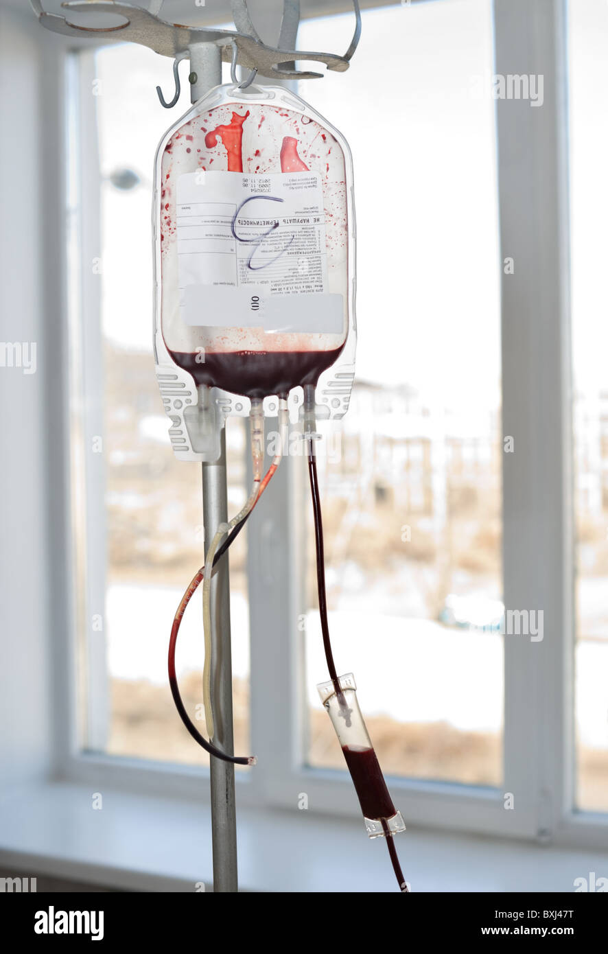 Confezione trasparente appeso sul rack è riempita con il sangue del donatore Foto Stock