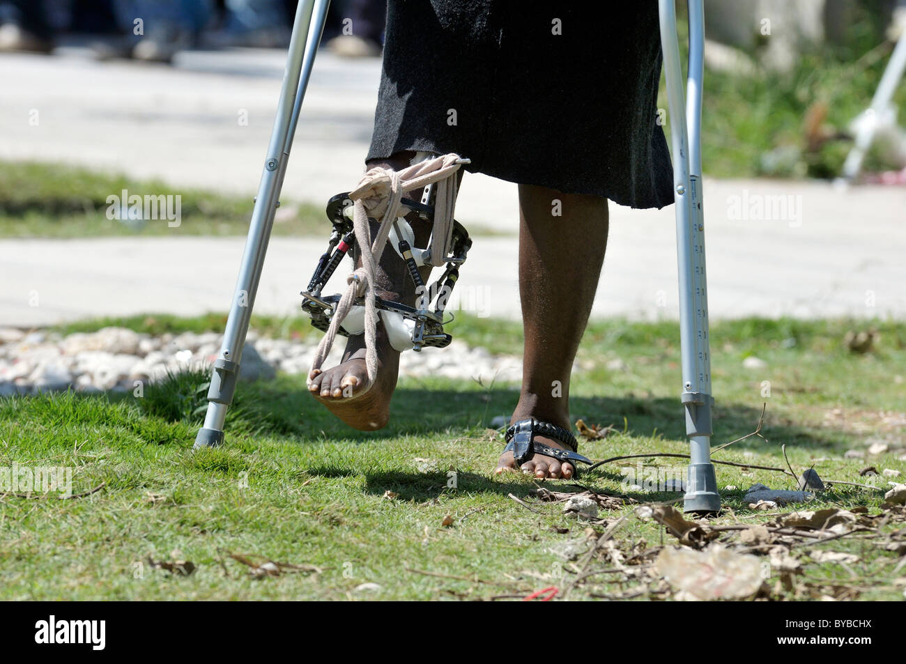 Giovane donna feriti nel gennaio 2010 terremoto è imparare a camminare di nuovo, Delmas 33 district, , Haiti, dei Caraibi Foto Stock
