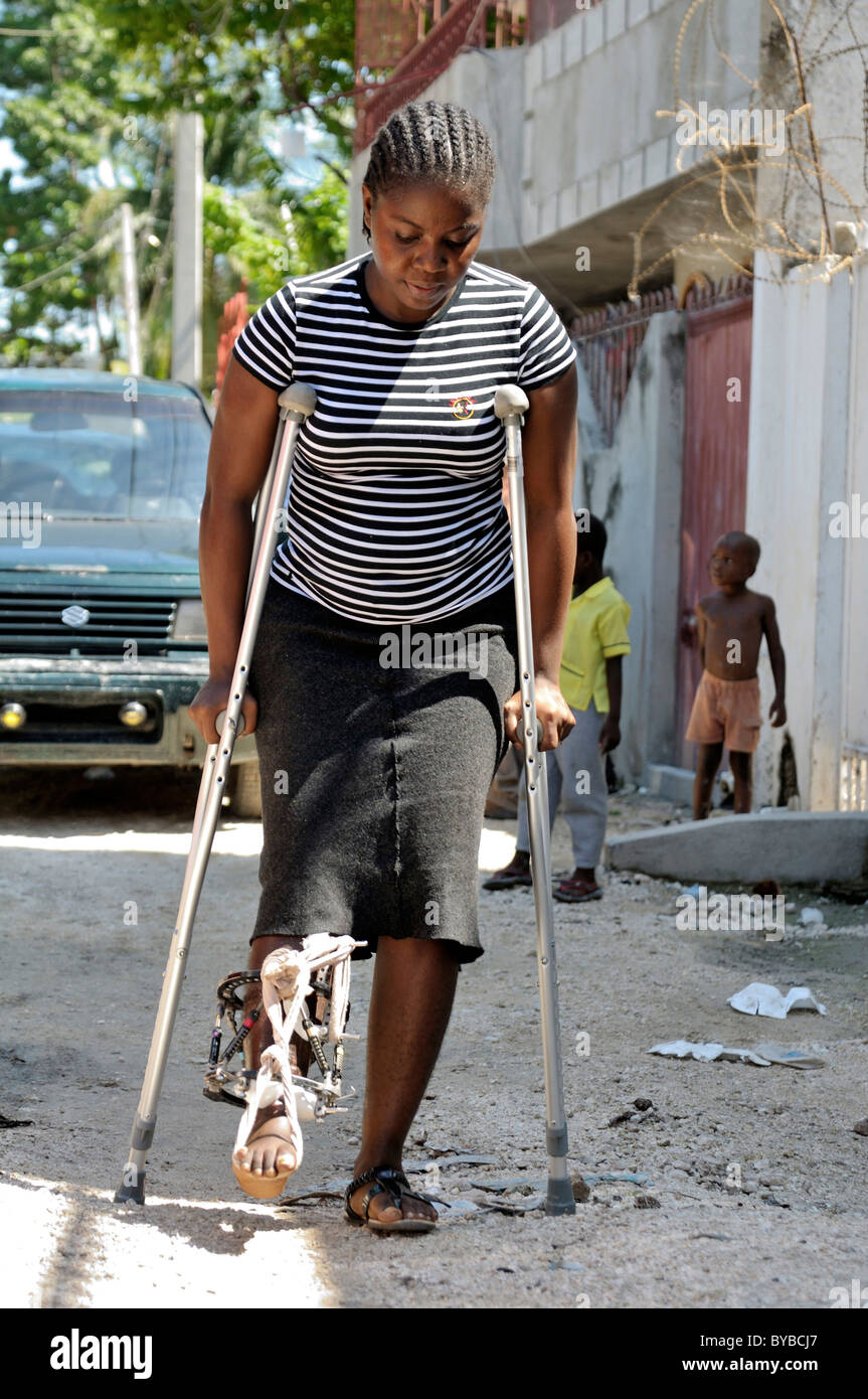 Giovane donna feriti nel gennaio 2010 terremoto è imparare a camminare di nuovo, Delmas 19 district, , Haiti, dei Caraibi Foto Stock