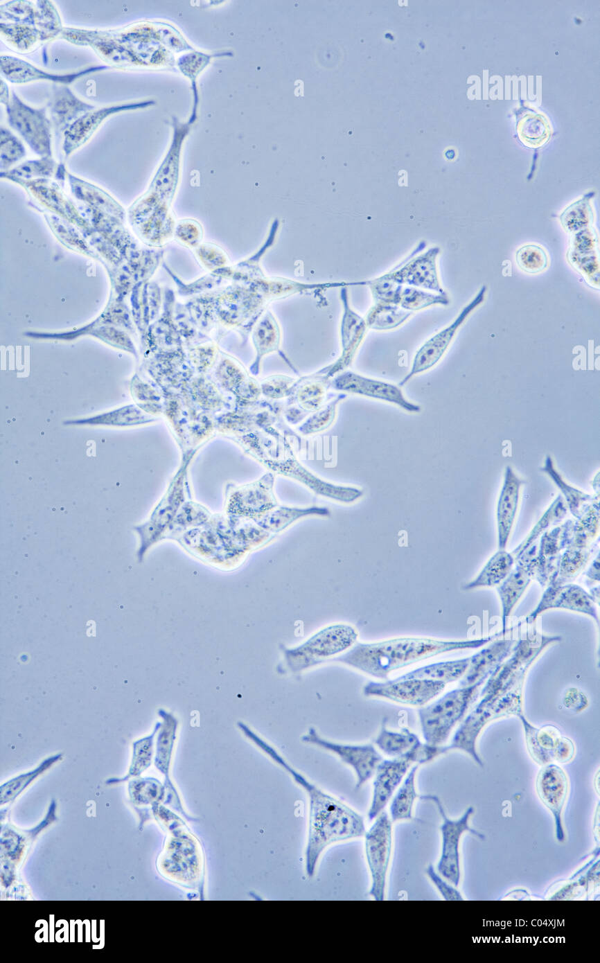 Vista al microscopio di cellule di cancro della prostata in coltura tissutale che mostra le pareti, nucleo e organelli. Foto Stock