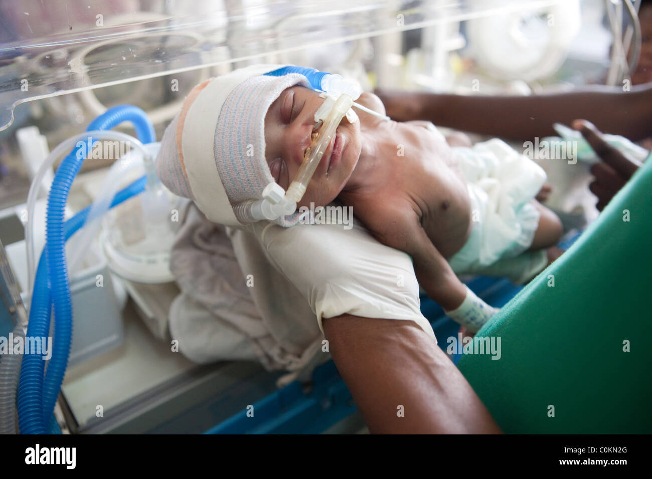 Un bambino prematuro riceve cure in cure speciali unità bambino in Ospedale Mulago a Kampala in Uganda. Foto Stock
