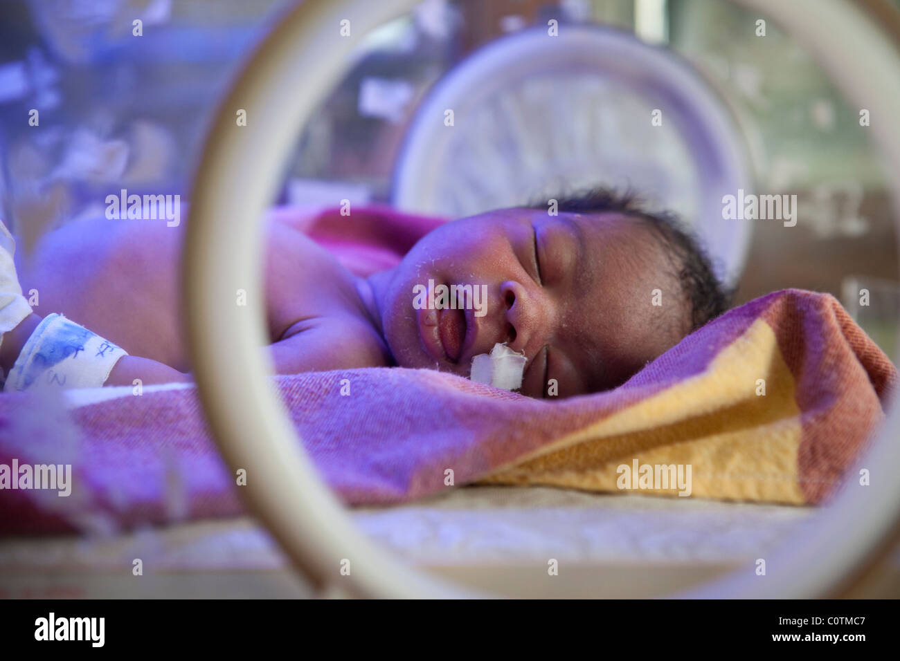 Un bambino prematuro riceve cure in cure speciali unità bambino in Ospedale Mulago a Kampala in Uganda. Foto Stock