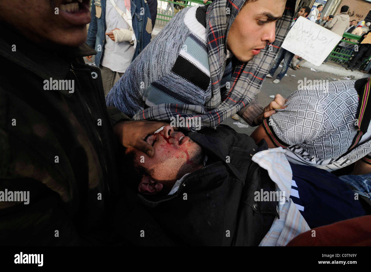 Un pro-democrazia protester feriti durante scontri di piazza Tahrir il 2 febbraio 2011 a Il Cairo, Egitto Foto Stock