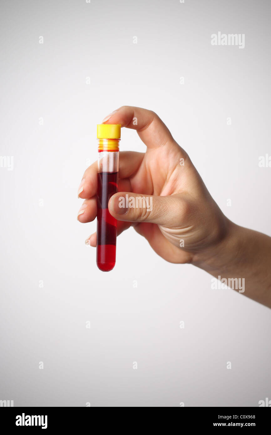 Femmina di mano che tiene il tubo di prova piena di sangue Foto Stock