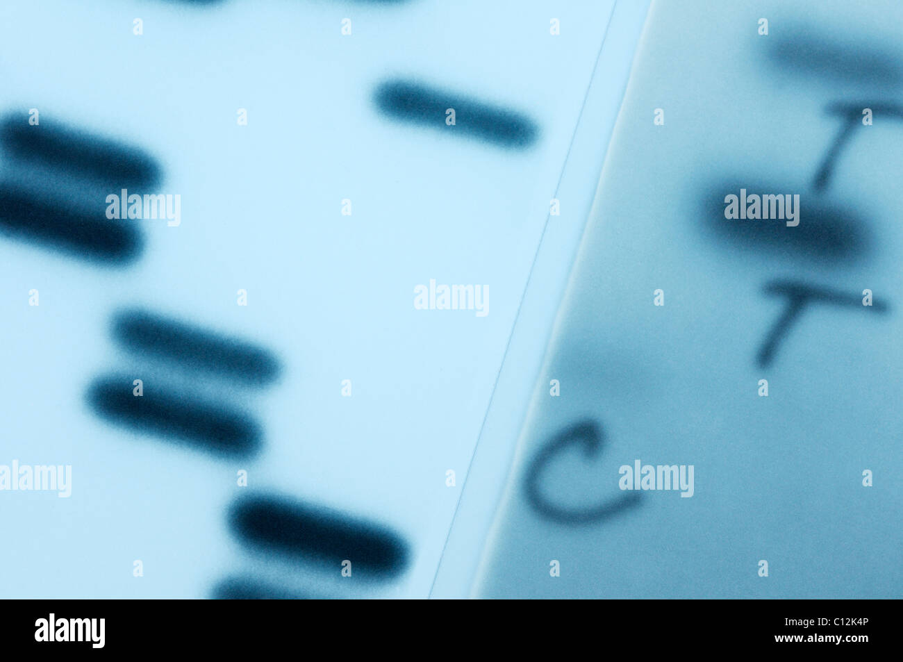 Il sequenziamento del DNA. Immagine a raggi X di un gel con DNA basi nucleotidiche (A,C,T,G) sequenziato. Metodo Sanger. Foto Stock