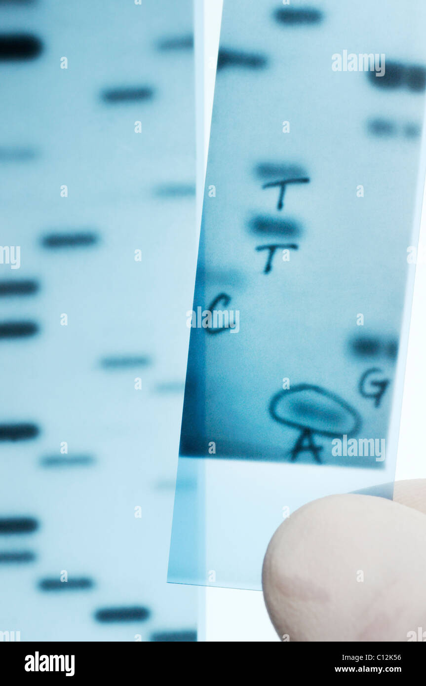 Il sequenziamento del DNA. Scienziato di trattenimento di un immagine a raggi X di un gel con DNA basi nucleotidiche (A,C,T,G) sequenziato. Metodo Sanger. Foto Stock