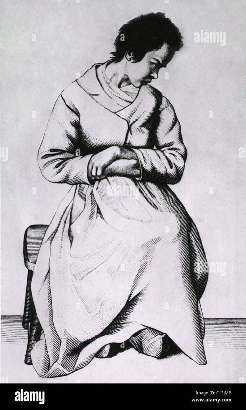 Una donna con lypemania (malinconia o depressione). Da Etienne Esquirol il libro che descrive i diversi tipi di disturbi mentali. Incisione di Ambroise TARDIEU. 1838. Foto Stock
