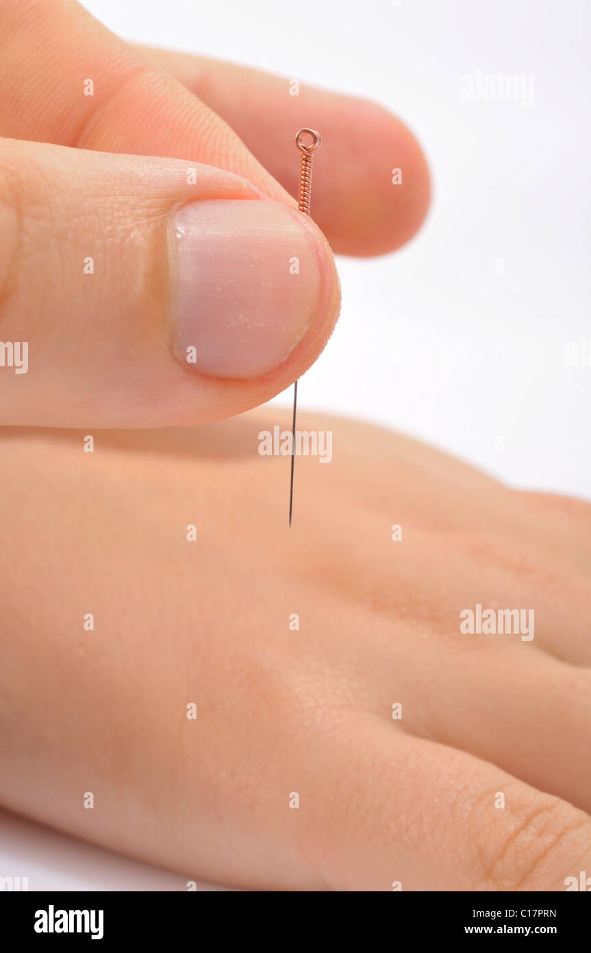 Dita posizionando un ago di agopuntura in un piede Foto Stock