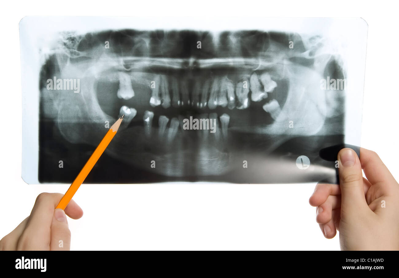 L uomo è in possesso di roentgen foto di denti Foto Stock