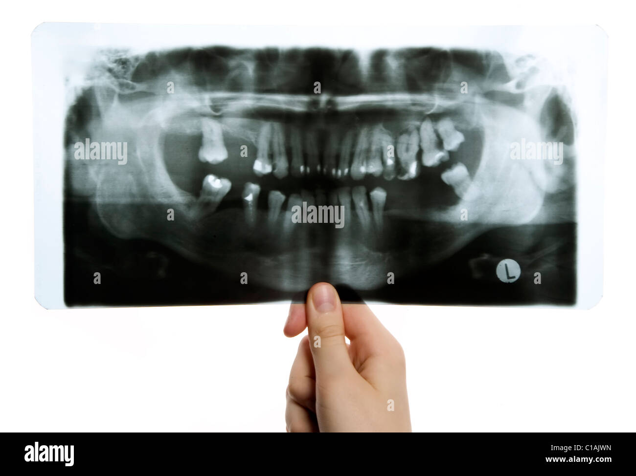 L uomo è in possesso di roentgen foto di denti Foto Stock