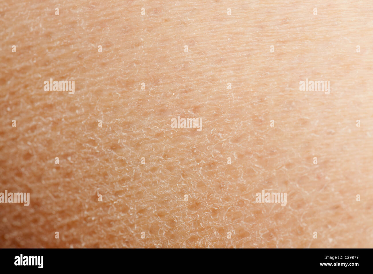 Un dettaglio macro sfondo della pelle secca Foto Stock