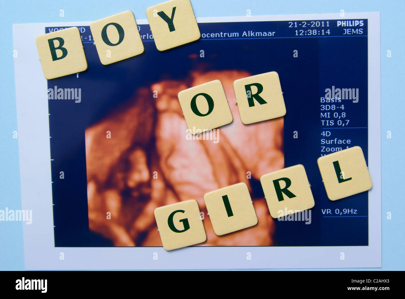 Baby ultrasuoni, è un ragazzo o una ragazza. Foto Stock