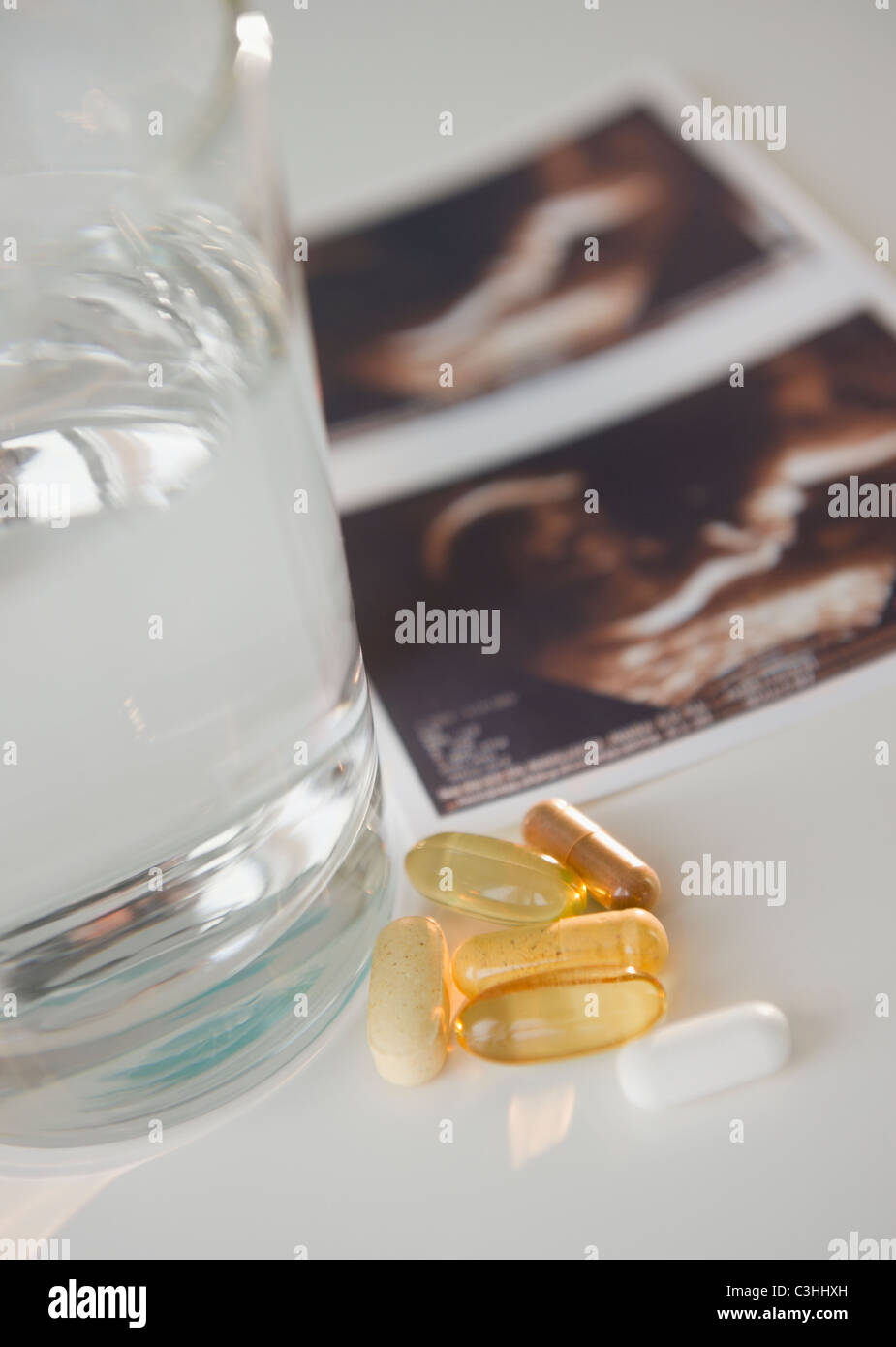 Sonogram foto, pillole e bicchiere di acqua Foto Stock