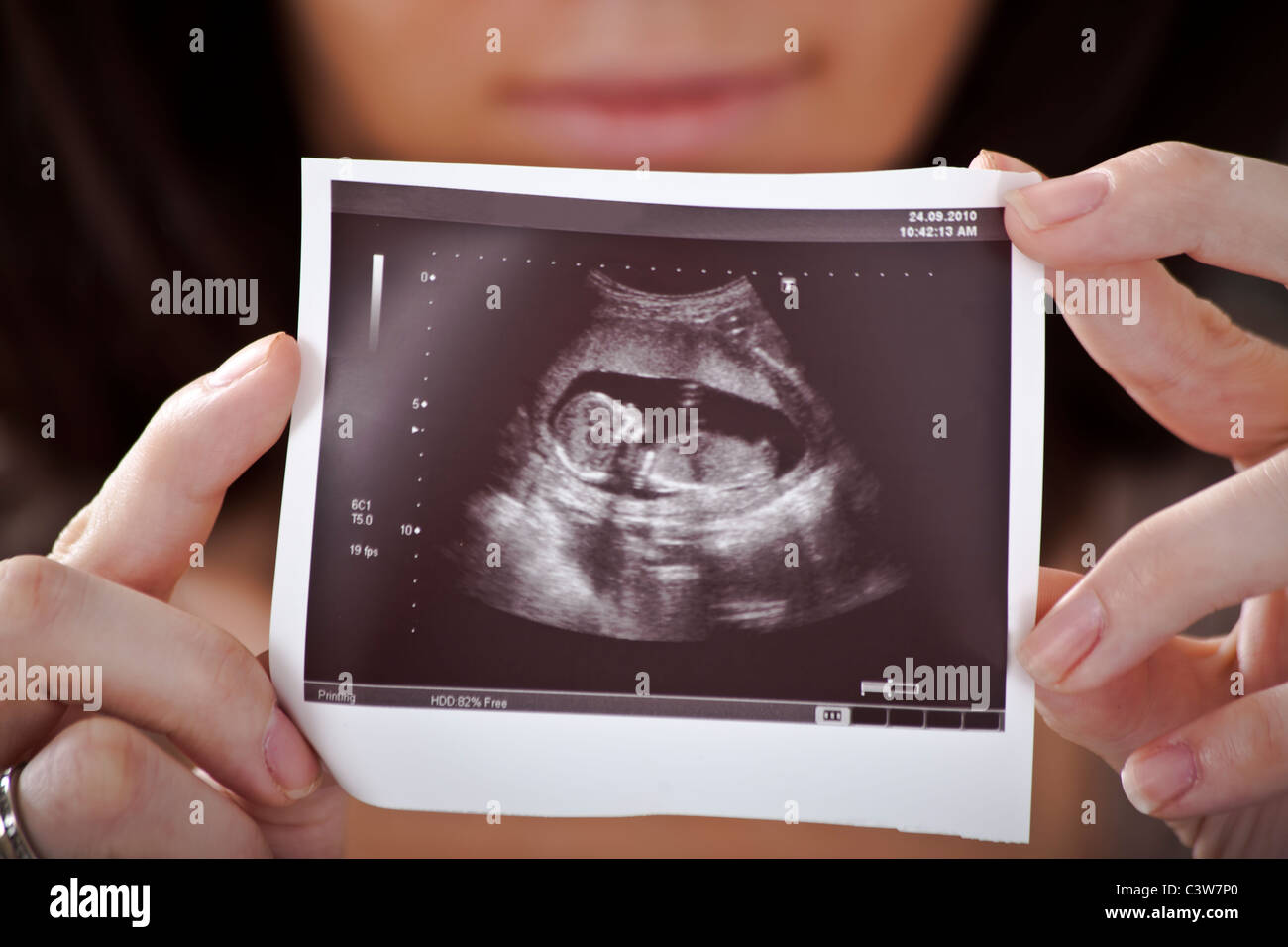 Felice e orgoglioso mamma con foto ad ultrasuoni del suo bambino Foto Stock