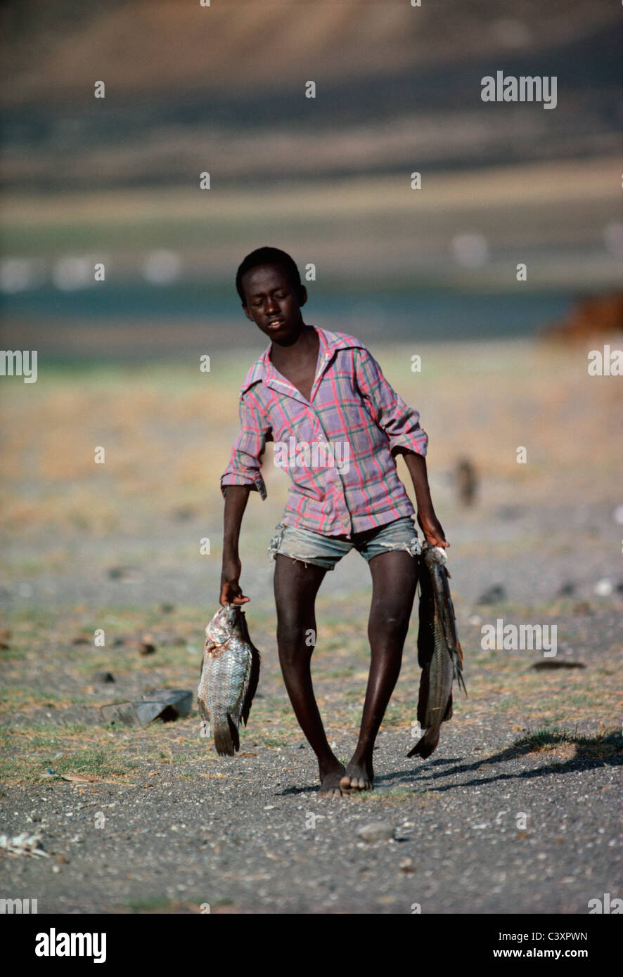 El Molo bambino soffre di rachitismo. Foto Stock