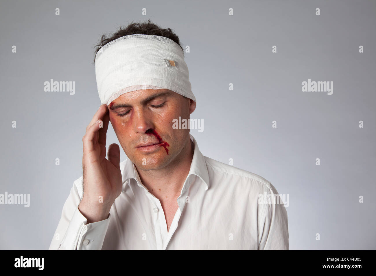 Un uomo con i lividi una sanguinosa naso e una testa fasciata Foto Stock