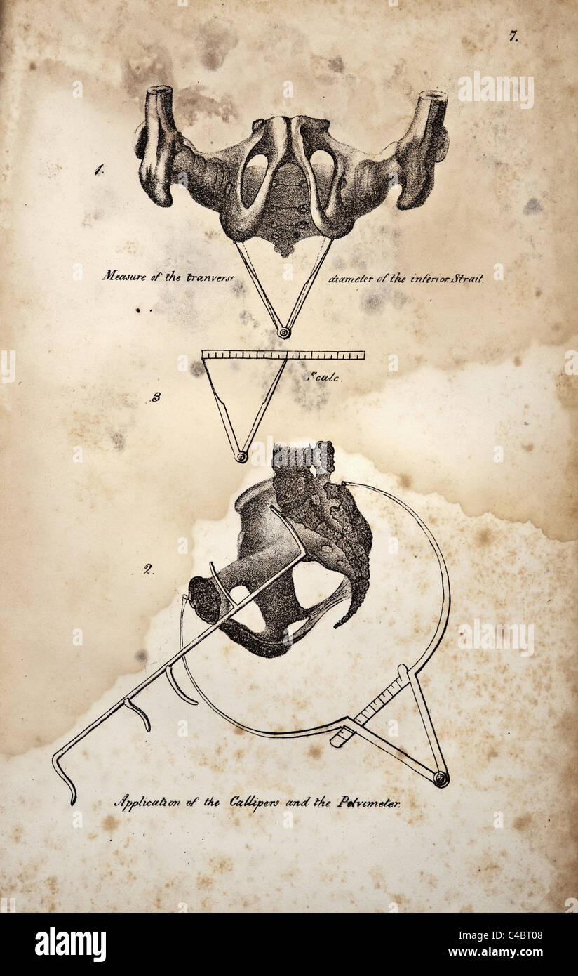 Illustrazione della pelvi umana copyright 1844 Foto Stock