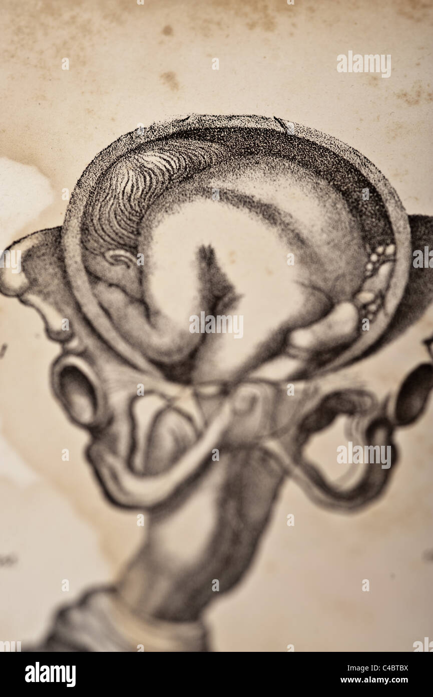 Illustrazione di un feto umano pre-nascita a osso pelvico circa 1844 Foto Stock