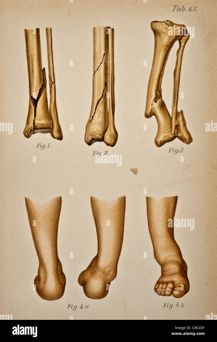 Illustrazione della caviglia umana copyright 1902 Foto Stock