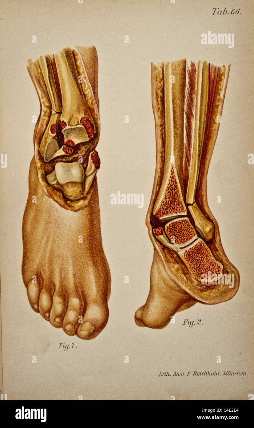 Illustrazione della caviglia umana copyright 1902 Foto Stock