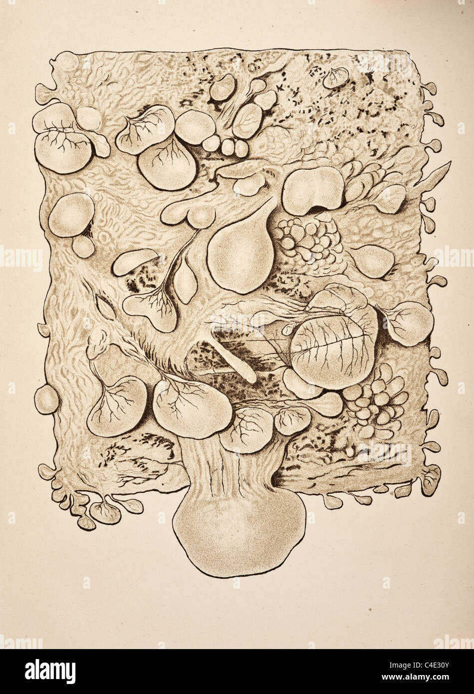 Ovariotomy e chirurgia addominale da Harrison Cripps copyright 1898 Foto Stock