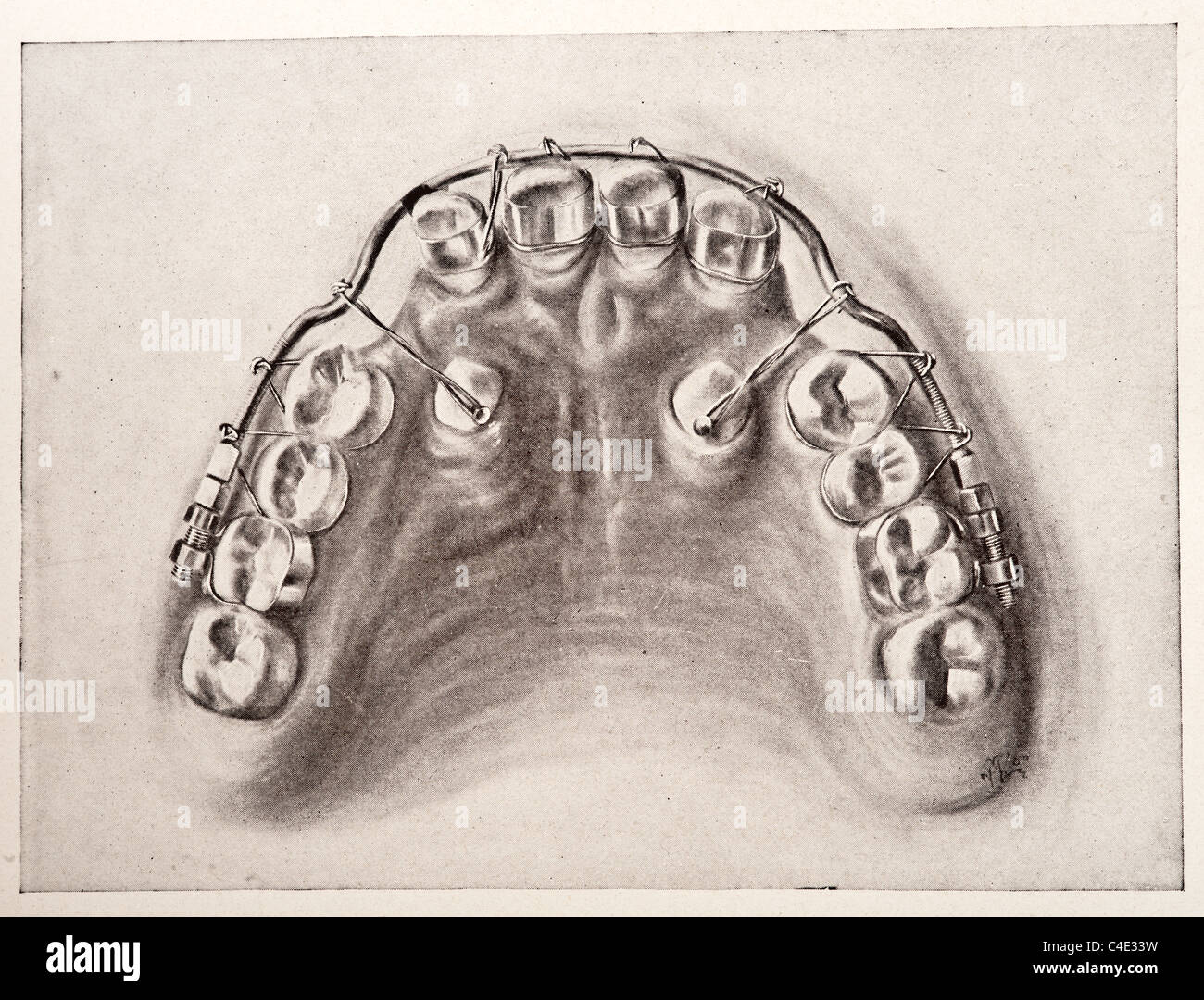 Illustrazione dei denti umani copyright 1911 Foto Stock