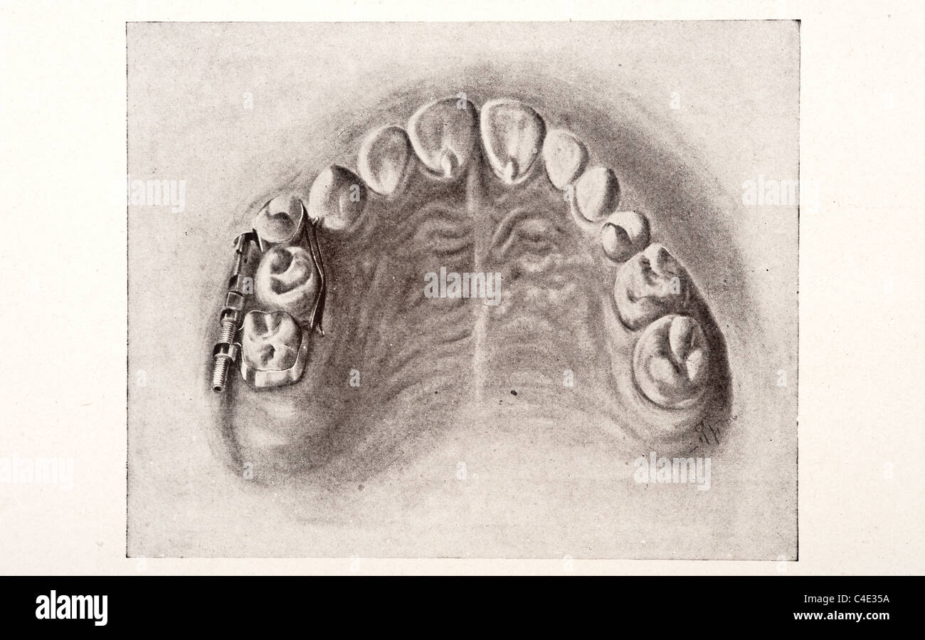 Illustrazione dei denti umani copyright 1911 Foto Stock