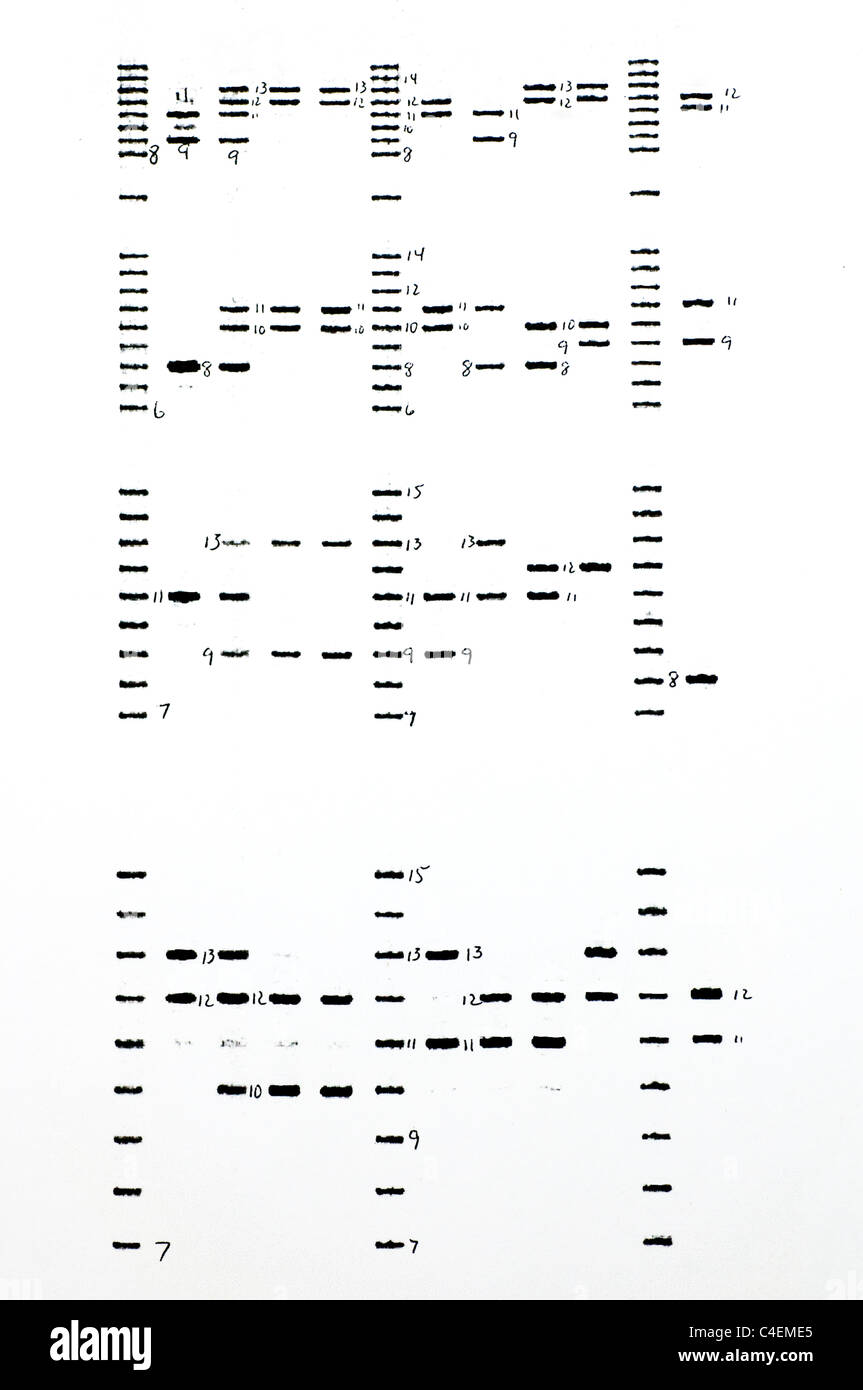 DNA forense risultati con analisi STR di campioni. Foto Stock