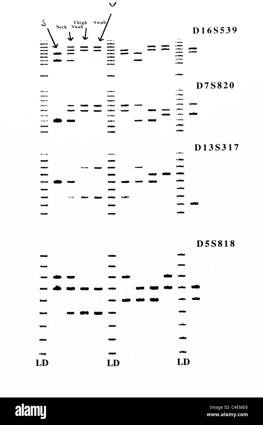 DNA forense risultati con analisi STR di campioni. Foto Stock