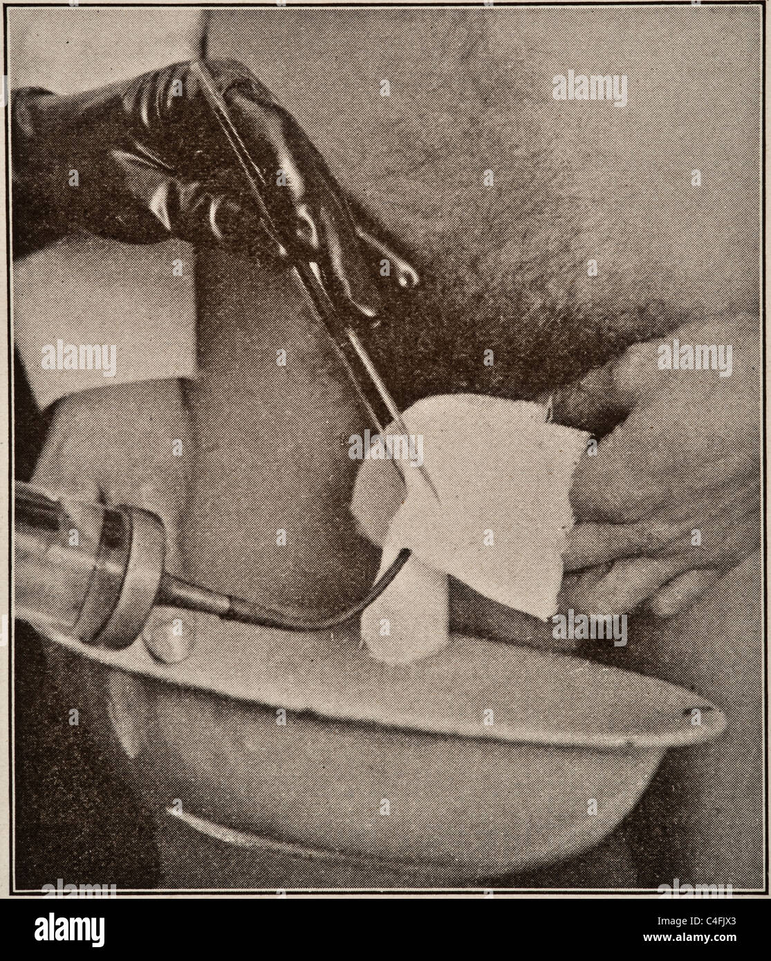 Urology di uomini donne e bambini da parte di Victor Pedersen copyright 1919 cistoscopia malattie malattia disturbo infezioni infezione procedura operativa di chirurgia sessuale tratto urinario uretroscopia urologo urologia Foto Stock