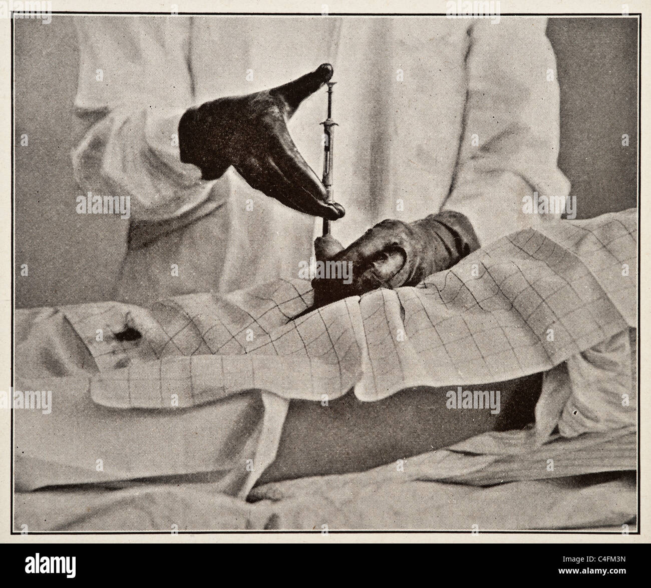 Urology di uomini donne e bambini da parte di Victor Pedersen copyright 1919 cistoscopia malattie malattia disturbo infezioni infezione procedura operativa di chirurgia sessuale tratto urinario uretroscopia urologo urologia Foto Stock