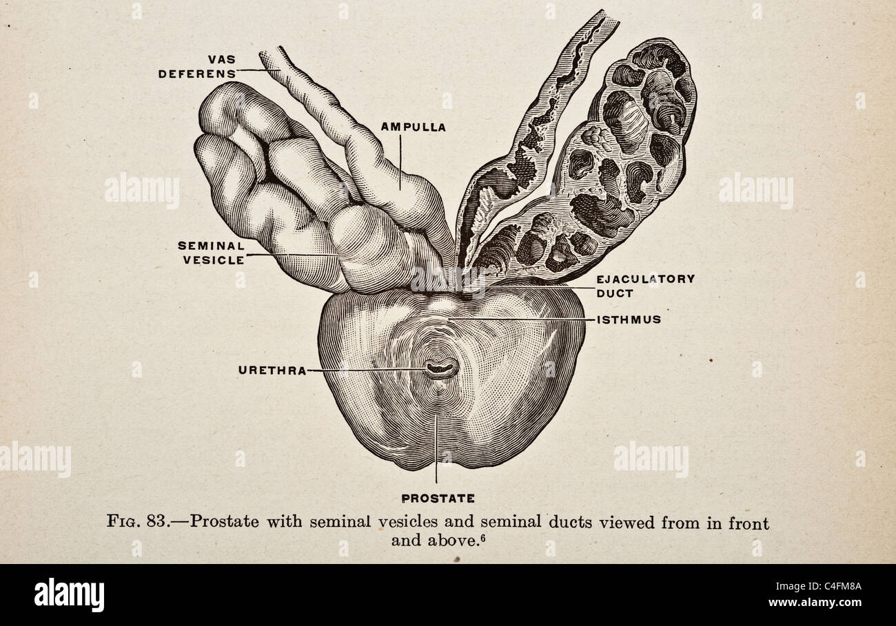 Urology di uomini donne e bambini da parte di Victor Pedersen copyright 1919 cistoscopia malattie malattia disturbo infezioni infezione procedura operativa di chirurgia sessuale tratto urinario uretroscopia urologo urologia Foto Stock