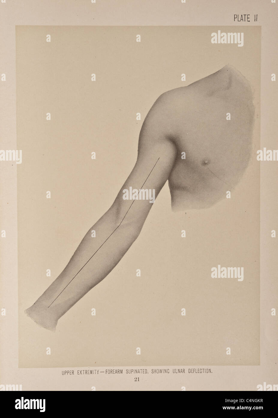 Illustrazione del braccio umano copyright 1899 Foto Stock