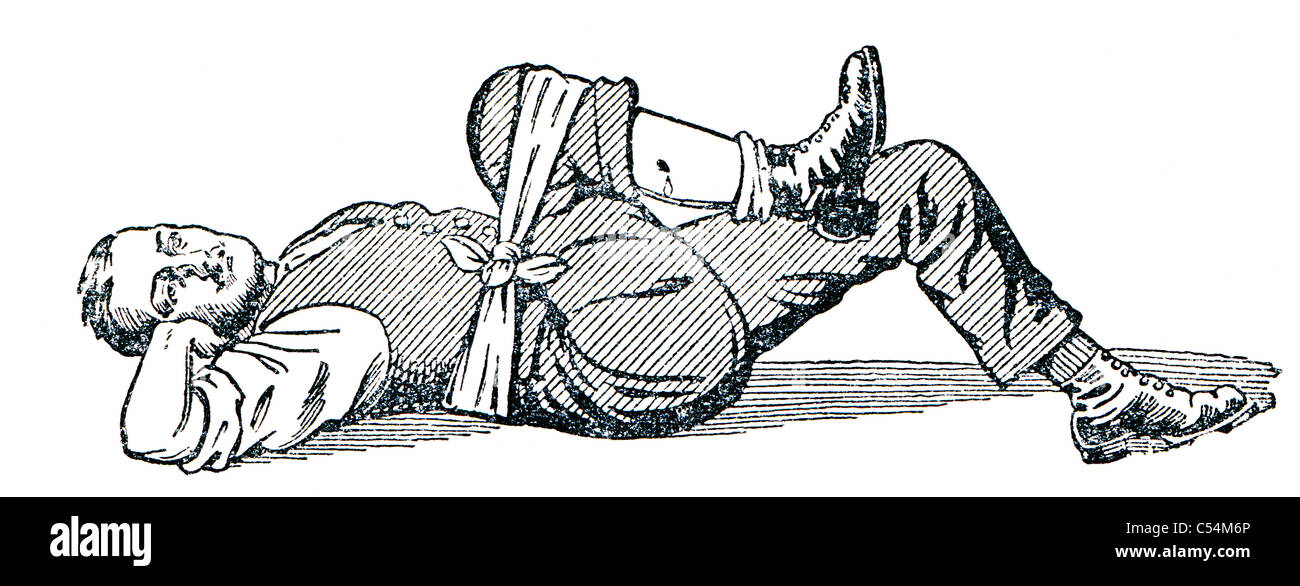 Primo soccorso per lo spurgo. Foto Stock