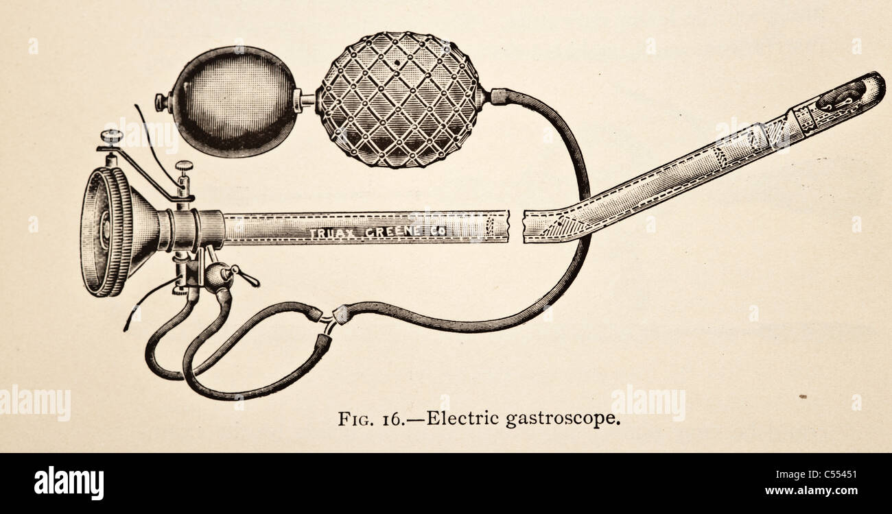 Vintage illustrazione di una apparecchiatura medica un elettrico gastroscope. Foto Stock