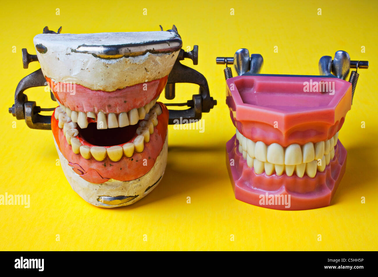 Modelli dentali, cattivo denti, buona denti Foto Stock