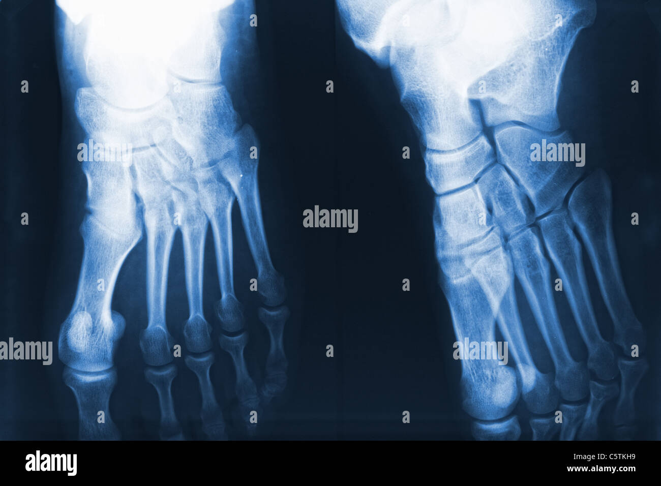 Dettaglio dei piedi dettaglio sullo sfondo Foto Stock