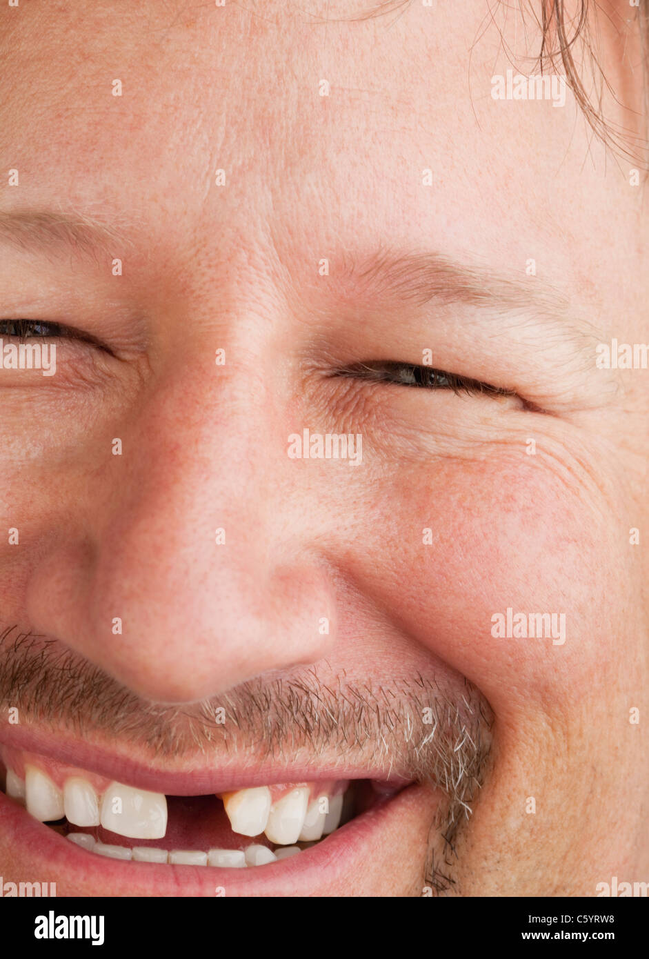 Ritratto di uomo con mancante dente anteriore Foto Stock