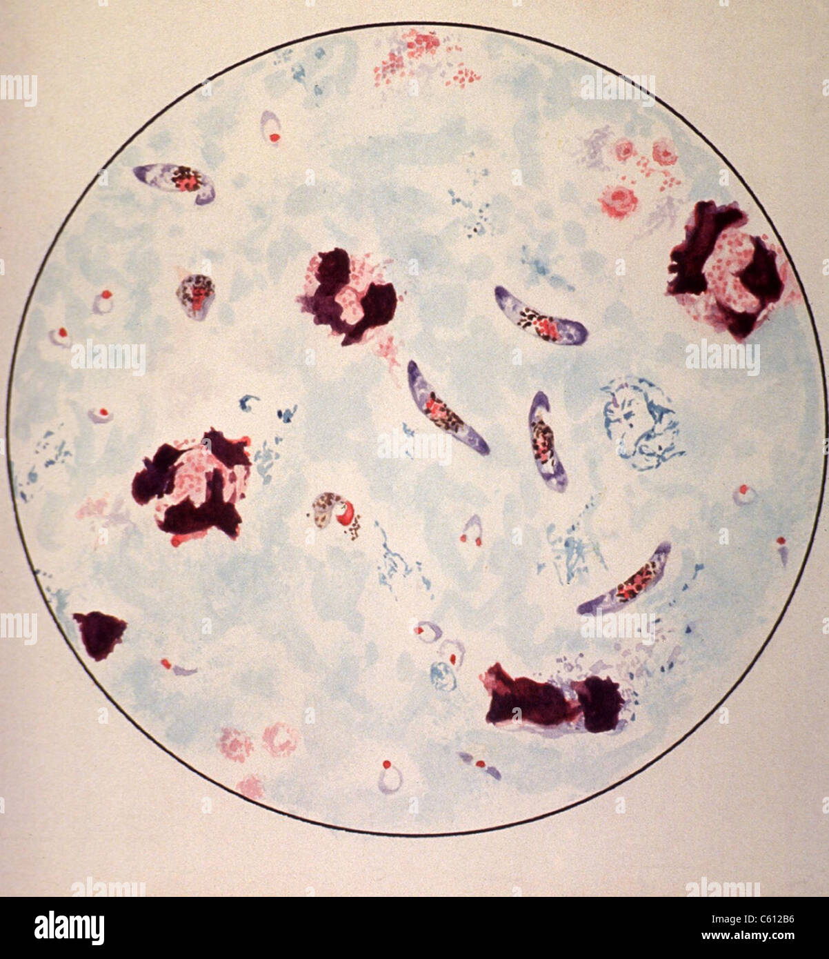 Vista al microscopio di un parassita di malaria dipinta da microscopiche di  vista da un manuale per aiutare nella diagnosi di malaria tra le truppe  degli Stati Uniti con sede di servizio