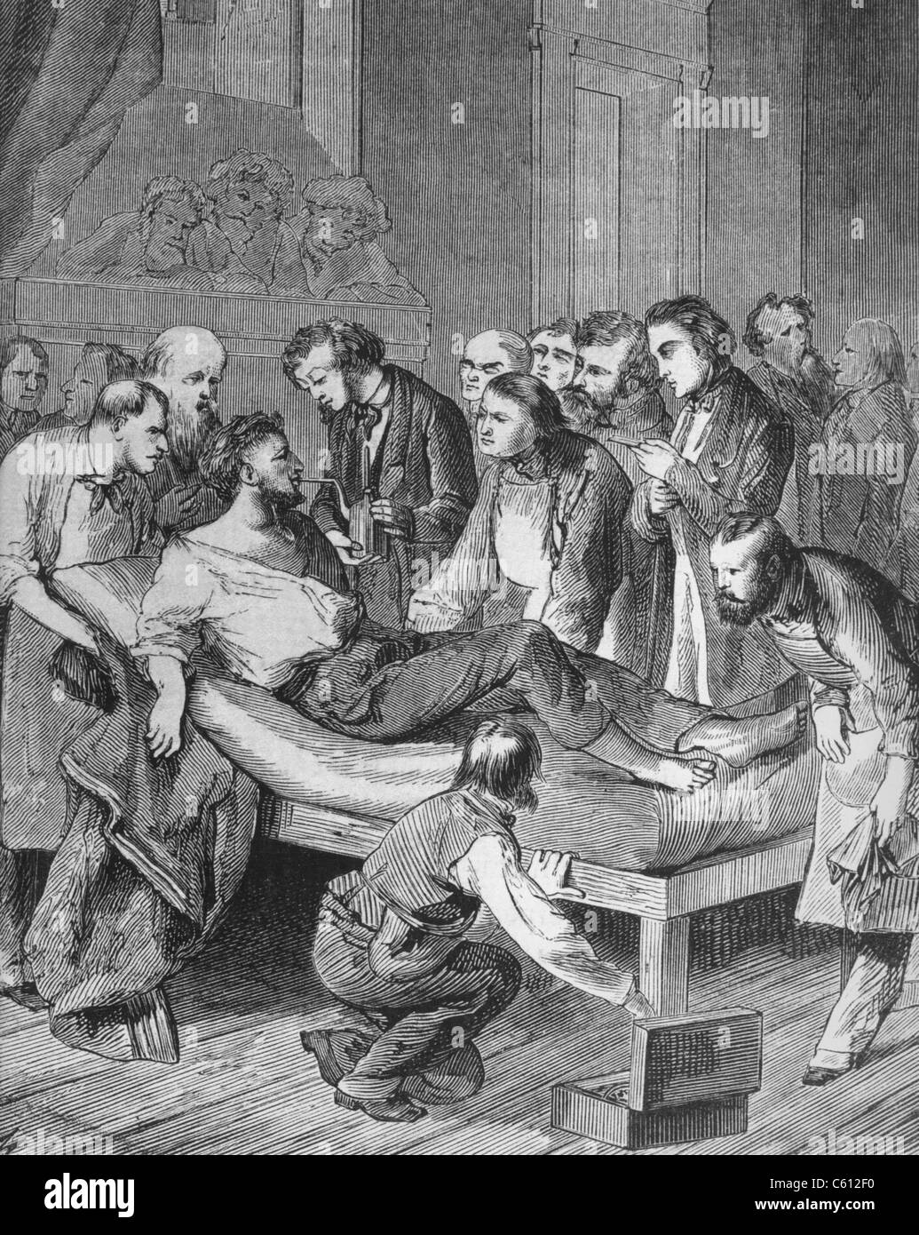 Prima somministrazione di etere per un paziente, Gilbert Abbott, sta per subire un intervento chirurgico per un tumore al collo presso il Massachusetts General Hospital, il 16 ottobre 1846. Foto Stock