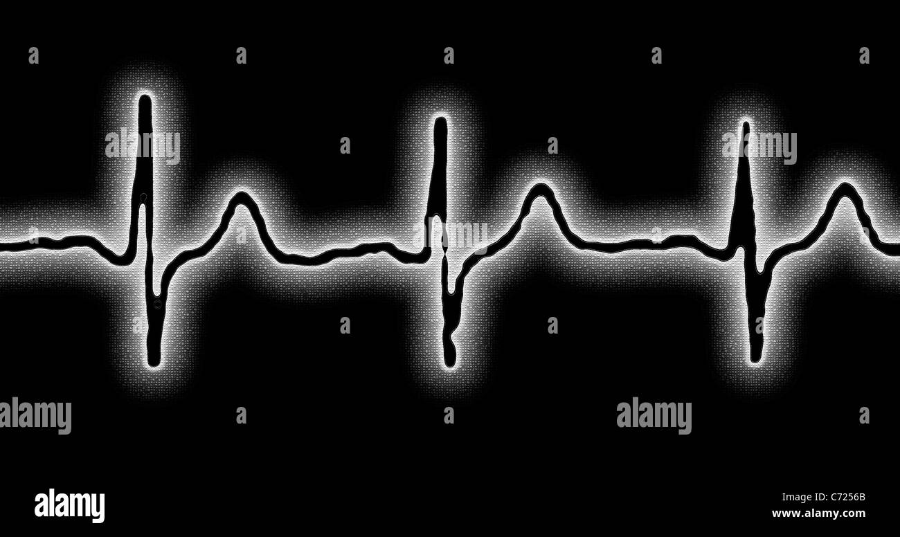 Elettrocardiogramma ECG Concept Foto Stock