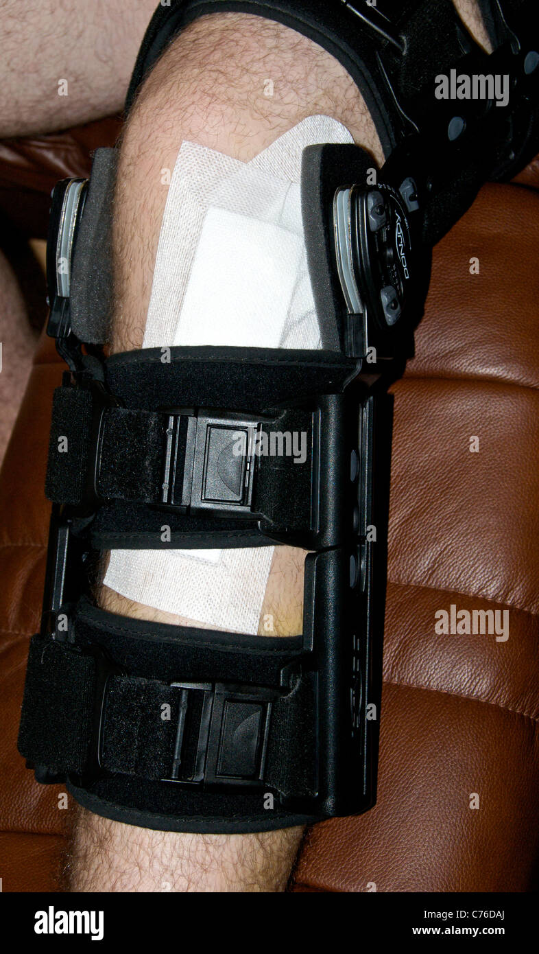 Lastra Ai Fosfori Per Imaging Dentale Digitale PSP Misura 2 - Foto 10